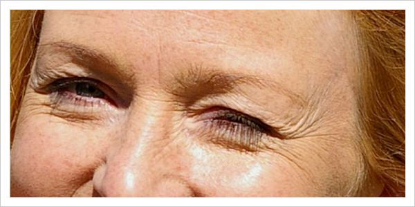  Pasos y remedios naturales para eliminar arrugas debajo de los ojos